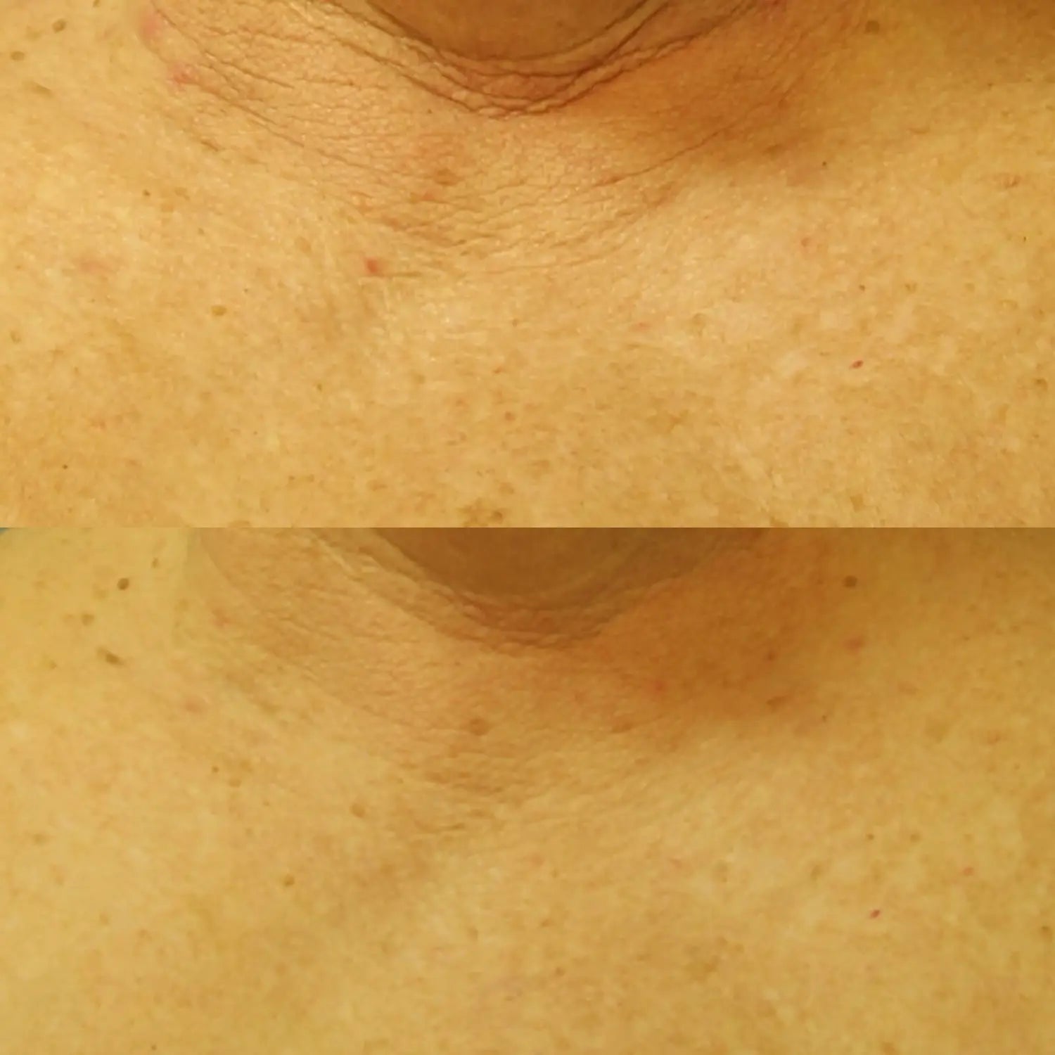 Perricone MD Neuropeptide Restorative Neck & Chest Therapy