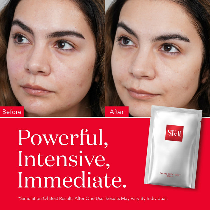 SK-II PITERA Facial Treatment Mask